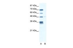 GliS2 Rabbit anti-Human, Polyclonal, Novus Biologicals 0.1ml; Unconjugated:Antibodies,